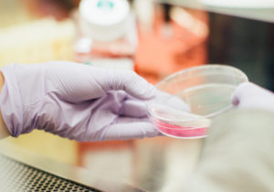 Μεταλλάξεις του γονιδίου FOXP3 μπορεί να εξηγούν την διέγερση του ανοσοποιητικού στην Π.Σ. και άλλες παθήσεις